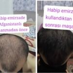 NUH SAÇ FIŞKIRTAN SAÇ BAKIM SETİ