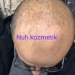 NUH SAÇ FIŞKIRTAN SAÇ BAKIM SETİ