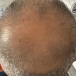 NUH SAÇ FIŞKIRTAN SAÇ BAKIM SETİ