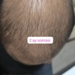 NUH SAÇ FIŞKIRTAN SAÇ BAKIM SETİ