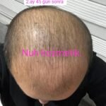 NUH SAÇ FIŞKIRTAN SAÇ BAKIM SETİ
