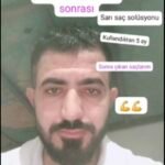 NUH SAÇ FIŞKIRTAN SAÇ BAKIM SETİ