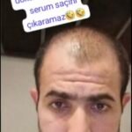 NUH SAÇ FIŞKIRTAN SAÇ BAKIM SETİ