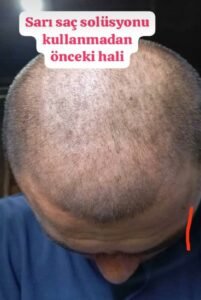 Müşteri değerlendirme görseli