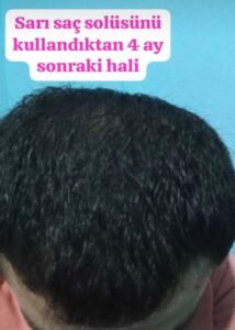 Müşteri değerlendirme görseli
