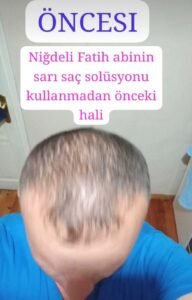 Müşteri değerlendirme görseli