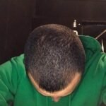 NUH SAÇ FIŞKIRTAN SAÇ BAKIM SETİ