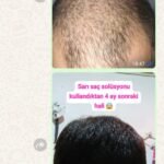 2 sarı saç solüsyonu 1 kalınlaştıran kür