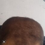 2 sarı saç solüsyonu 1 kalınlaştıran kür
