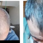 2 sarı saç solüsyonu 1 kalınlaştıran kür