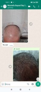 Müşteri değerlendirme görseli