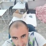 2 sarı saç solüsyonu 1 kalınlaştıran kür