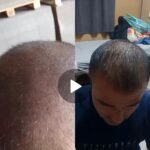 2 sarı saç solüsyonu 1 kalınlaştıran kür