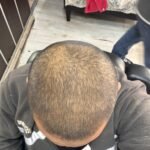 2 sarı saç solüsyonu 1 kalınlaştıran kür